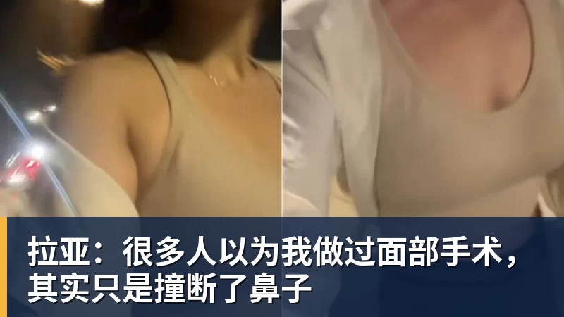 拉亚：很多人以为我做过面部手术，其实只是撞断了鼻子